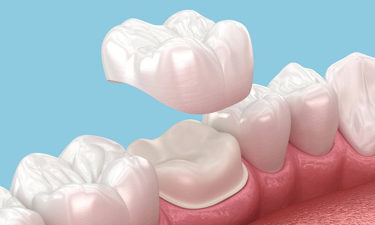 Quality Premium Dental